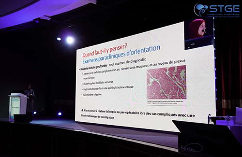 25<sup>ème</sup> Journée de Gastro-Entérologie de Sousse