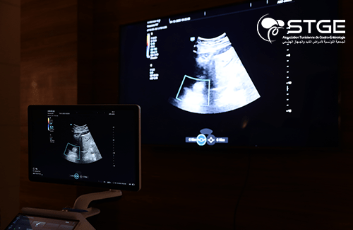 29<sup>ème</sup> Congrès national de la Société Tunisienne de Gastro-entérologie 2025